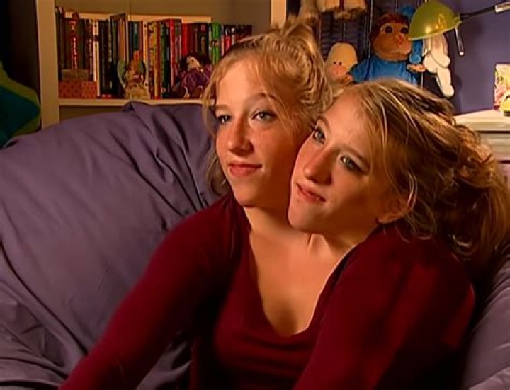 Abby And Brittany's Heartbreaking Journey"