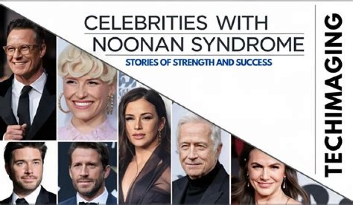 Unveiling The Extraordinary: Celebrities With Noonan Syndrome