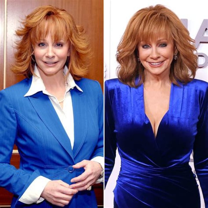 Unveiling The Reba McEntire Plastic Surgery Saga: Surprising Truths Revealed